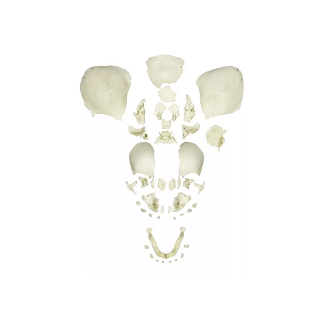 Gesprengter Fötusschädel voll entwickelt – Anatomiemodell zur forensischen & anthropologischen Ausbildung - Erler - Zimmer